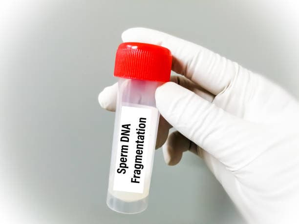 DNA Fragmentation Test