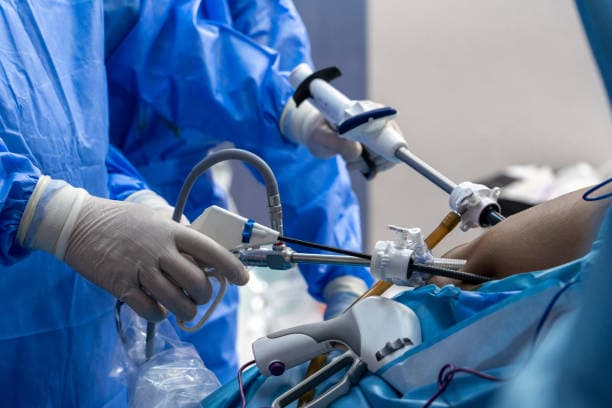 Laparoscopy