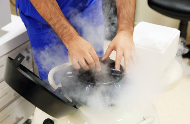 Sperm Freezing